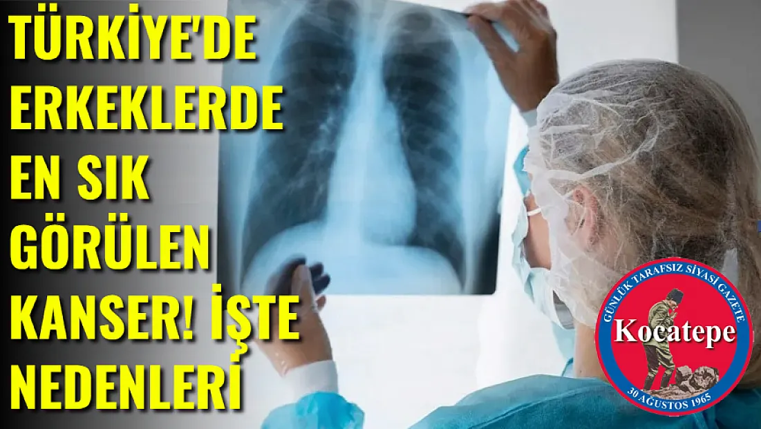 Türkiye’de Erkeklerde En Sık Görülen Kanser! İşte Nedenleri