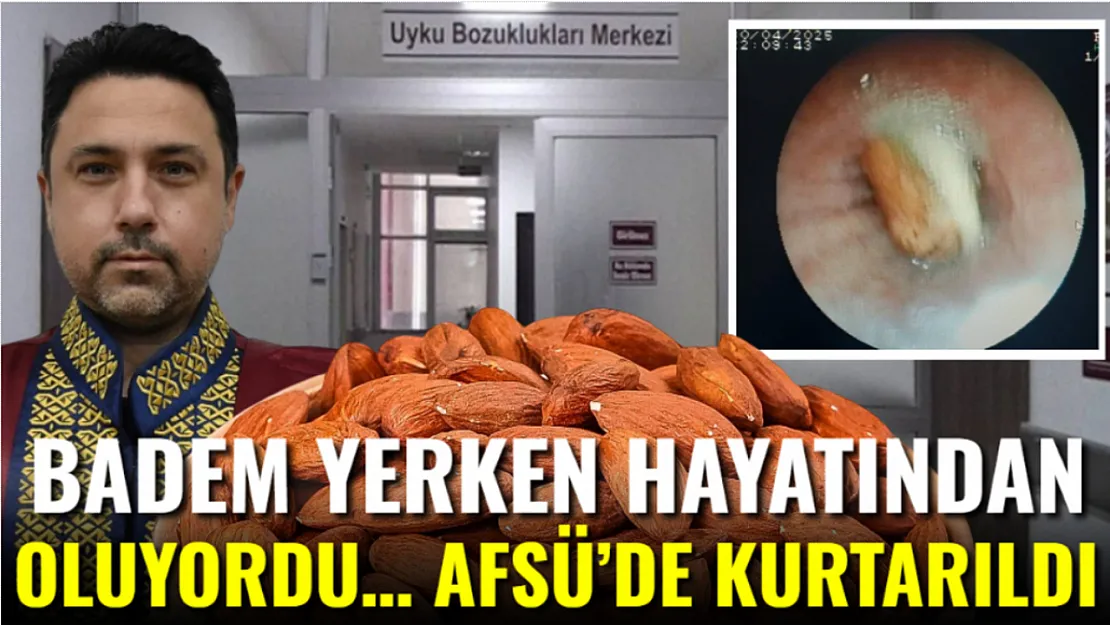 Badem yerken hayatından oluyordu… AFSÜ'de kurtarıldı