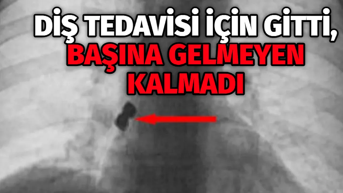 Diş tedavisi için gitti, başına gelmeyen kalmadı