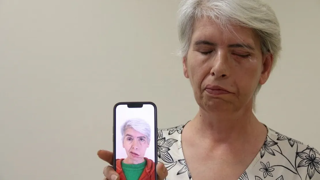 Sol Gözünü 41 Yıl Sonra 24 Ayar Altınla Yapılan Tedavi Sonucu Kapattı