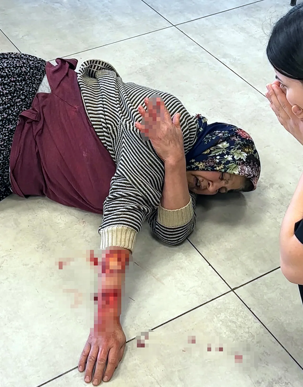 Afyon'da Dehşete Düşüren Köpek Saldırısı