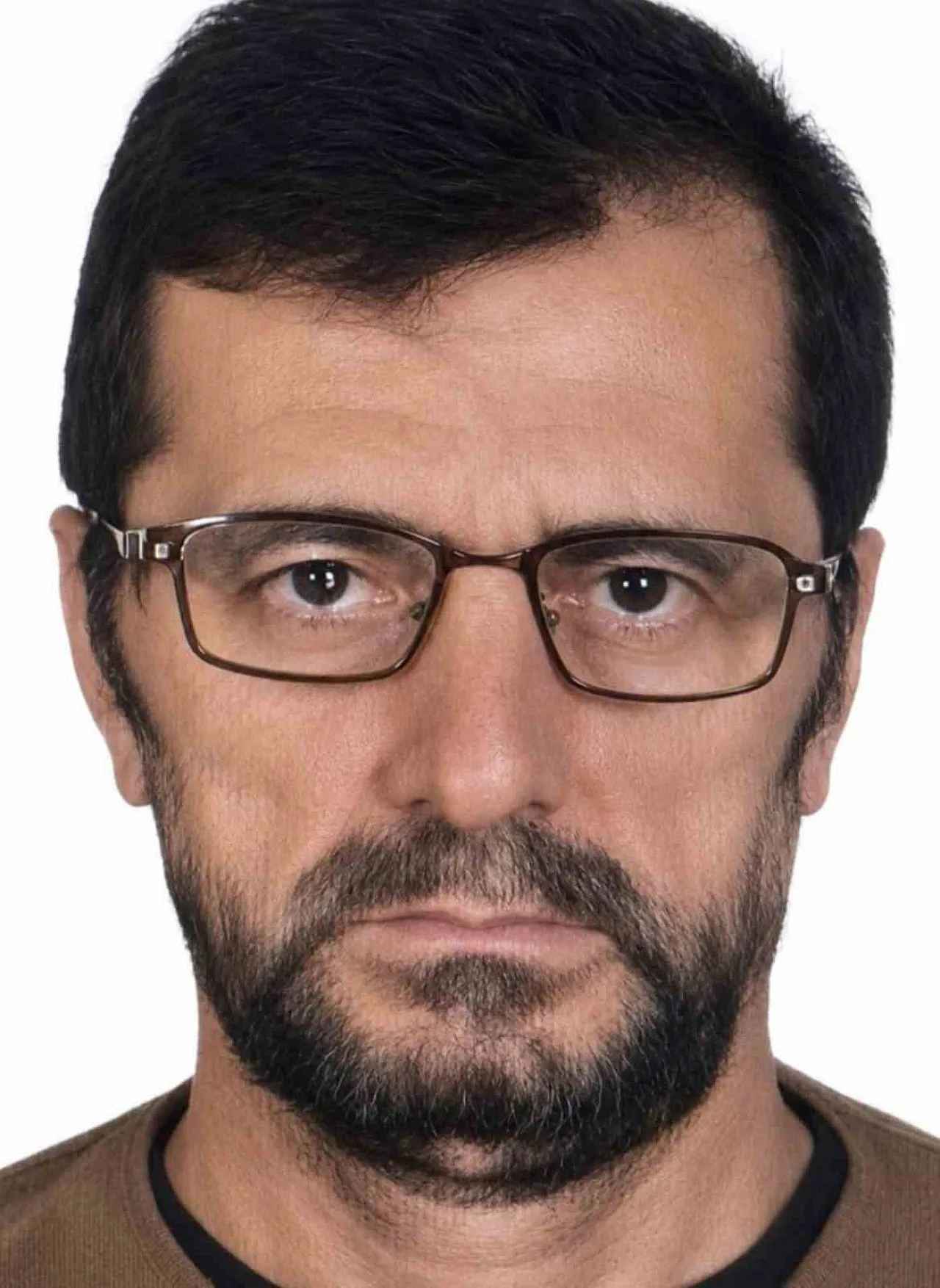 Bahçede Yanmış Halde Bulundu!