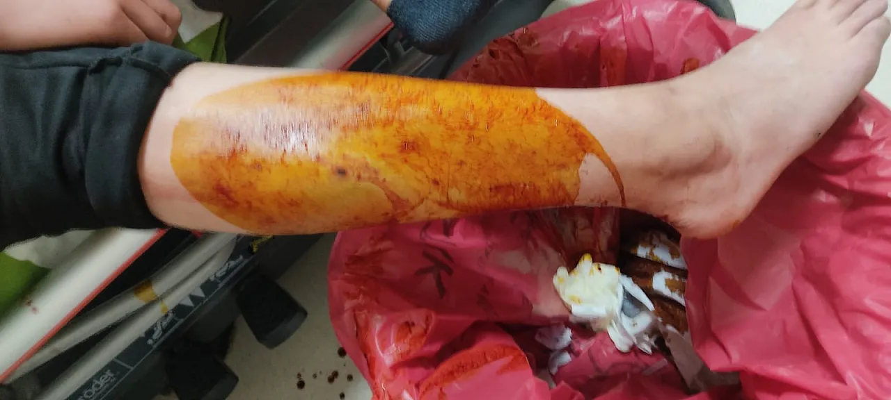 Afyon'da Yaralı Gencin Ağzından Küfür Çıktı, Doktor Hipokrat'ı Unuttu!