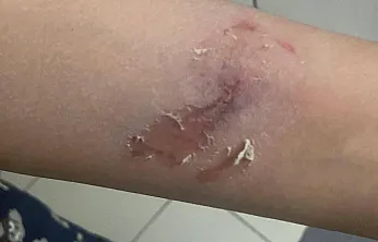 Afyon'un Merkezinde Dehşet Anları!