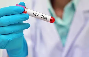 AIDS'ten Korunmak İçin Nelere Dikkat Edilmeli?