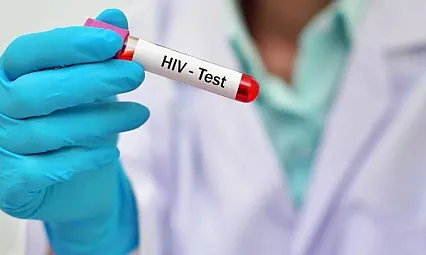 AIDS'ten Korunmak İçin Nelere Dikkat Edilmeli?