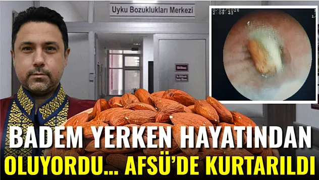 Badem yerken hayatından oluyordu… AFSÜ'de kurtarıldı