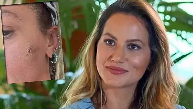 Yıldız Asyalı Darp Mı Edildi?