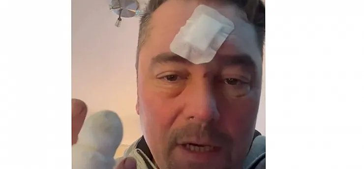 Türk Rap Müziğinin Efsanesi Erci-E Sahneden Düştü