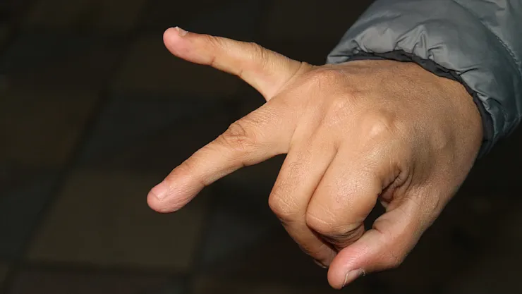Bozuk Çıkan Ve İade Etmek İstediği Balıklarla Darp Edilen Adam Parmağından Oldu