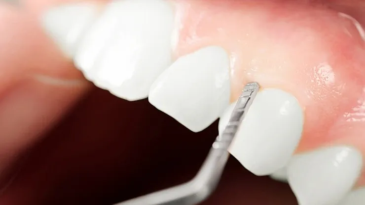 Engelli bireylere diş taraması – Kocatepe Gazetesi