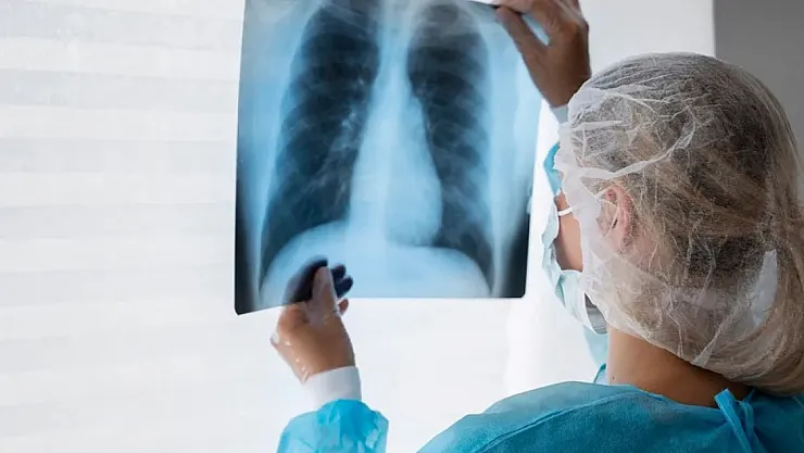 Türkiye'de Erkeklerde En Sık Görülen Kanser! İşte Nedenleri