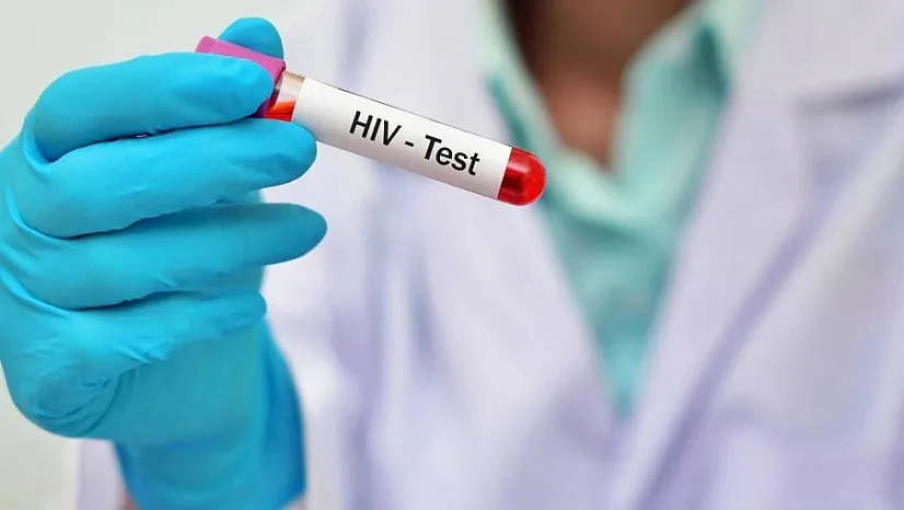 AIDS'ten Korunmak İçin Nelere Dikkat Edilmeli?