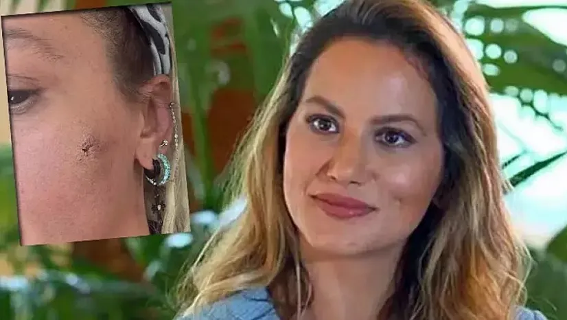 Yıldız Asyalı Darp Mı Edildi?