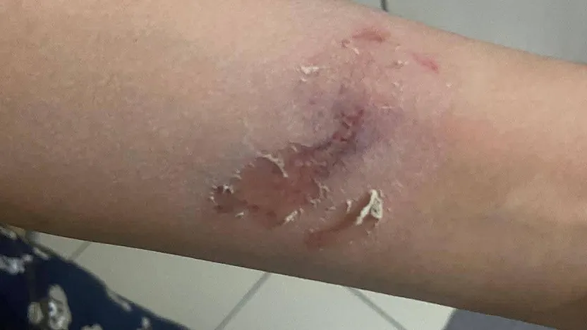 Afyon'un Merkezinde Dehşet Anları!