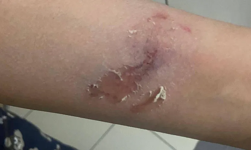 Afyon'un Merkezinde Dehşet Anları!