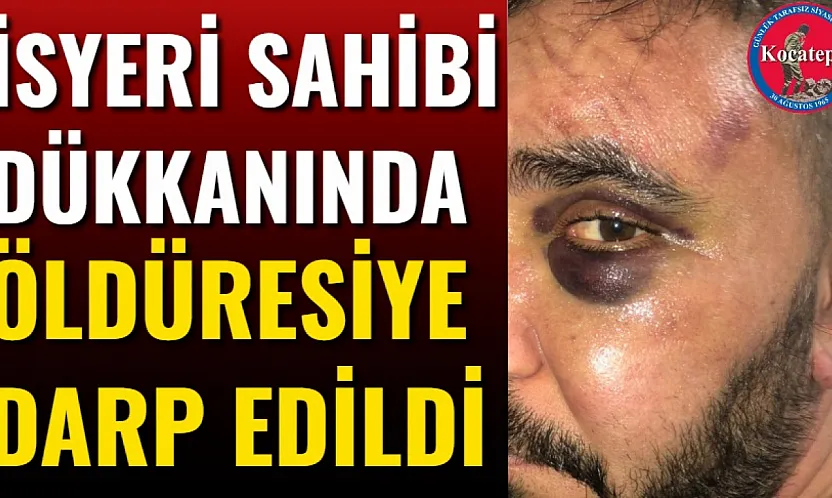 İsyeri Sahibi Dükkanında Öldüresiye Darp Edildi