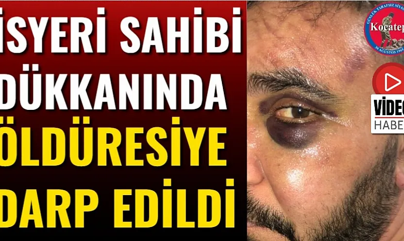 İşyeri Sahibi Dükkanında Öldüresiye Darp Edildi